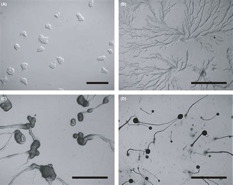  ディctyostelium discoideum: 単細胞生物が集団知性で建築を始める驚きの生態とは！？